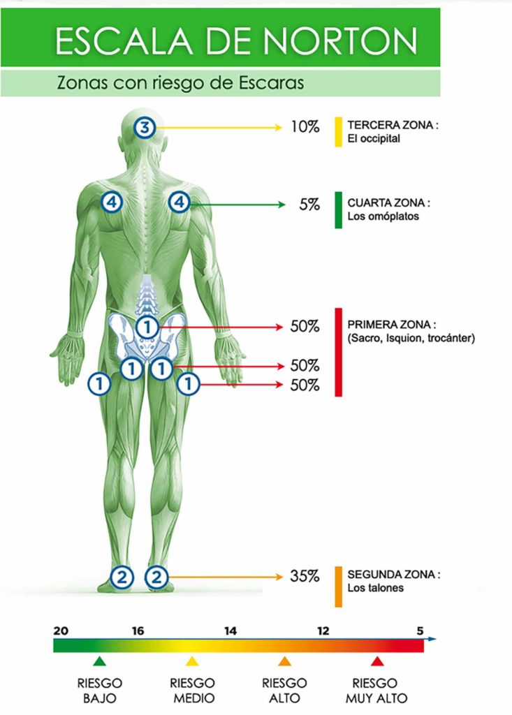 Escala Norton que indica las zonas de riesgo de escaras